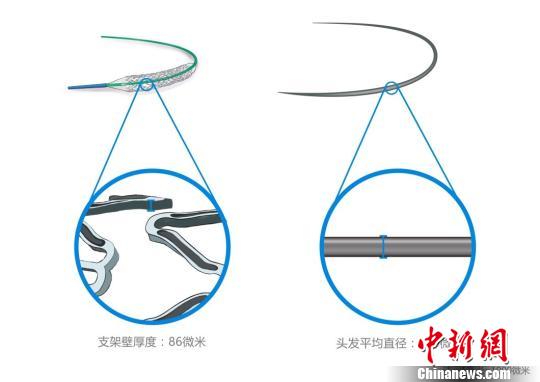 火鷹支架壁的凹槽與頭發(fā)直徑對比圖?！」﹫D 攝