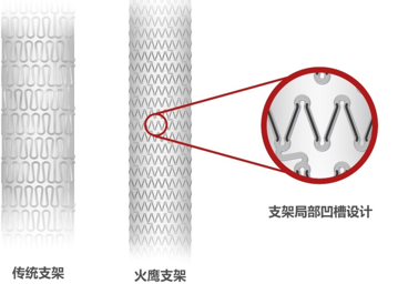 第二代傳統(tǒng)藥物洗脫支架與“火鷹支架”的結構設計對比